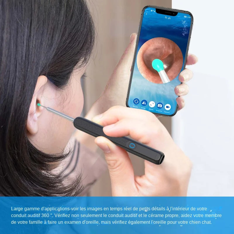 SmartVision Ear Cleaning System